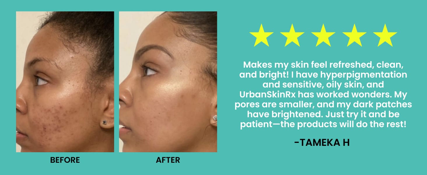 Even Tone Cleansing Bar Review
