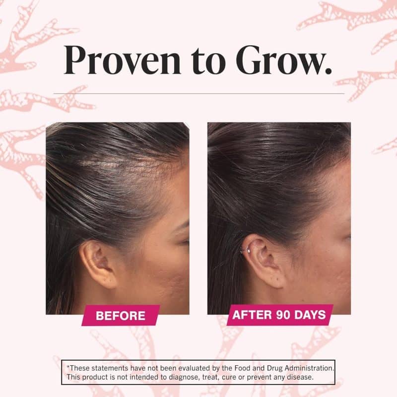 Viviscal Hair Growth Supplements - Image 6